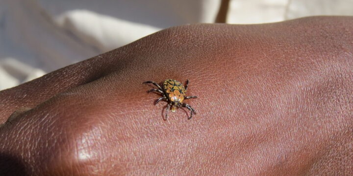 A tick on a person's hand