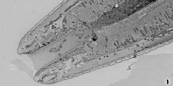 black and white image of a nematode under a microscope