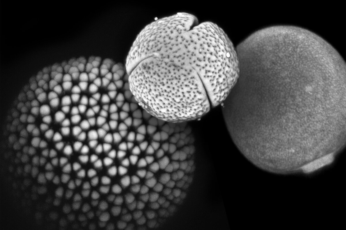Microscopic image of pollen grains from Croton hirtus