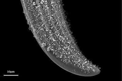 a magnified spine found on the hind legs of insects called leafhoppers.